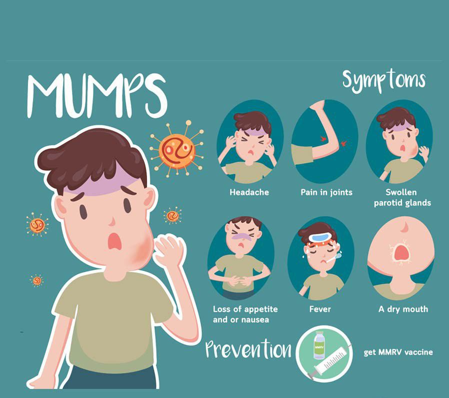 Symptoms of Mumps - MEDizzy