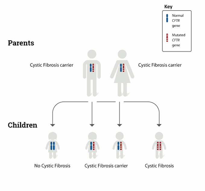 Cystic fibrosis causes