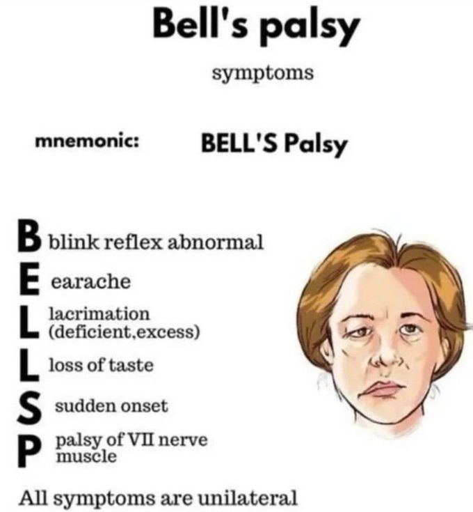 Bells Palsy