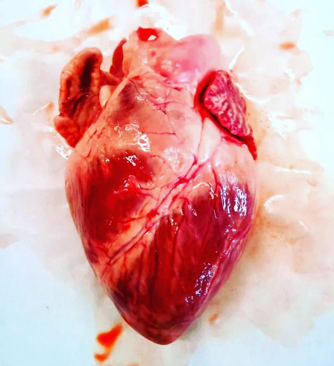Heart