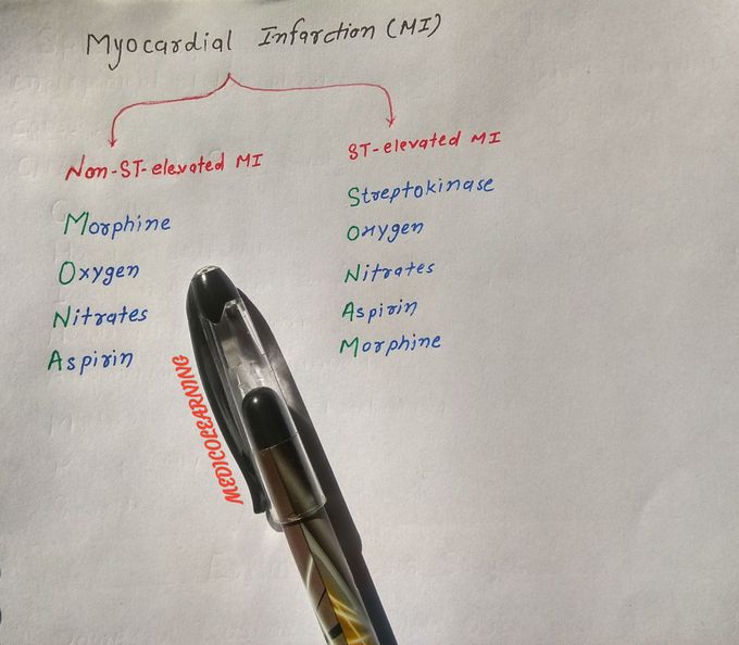 Myocardial Infarction