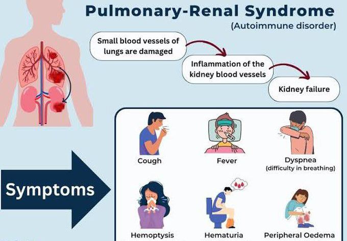 These are the symptoms of Pulmonary Renal syndrome