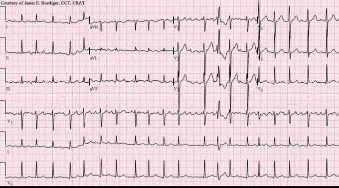 What is your diagnosis?