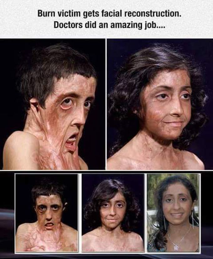 Mad respect 🙇, facial reconstruction