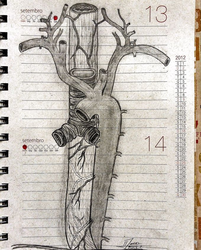 Thoracic Aorta