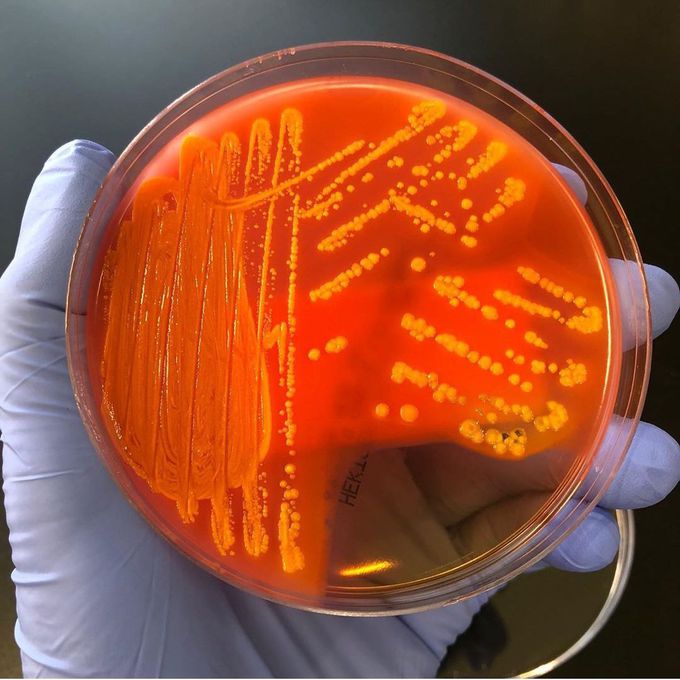 Pneumoniae on  Hektoen.