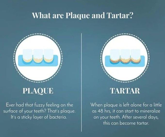 Plaque vs Tartar