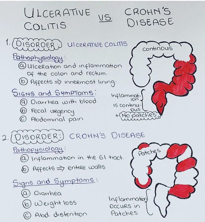 Irritable Bowel Disease