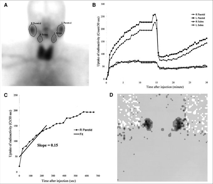 Salivary gland scintigraphy