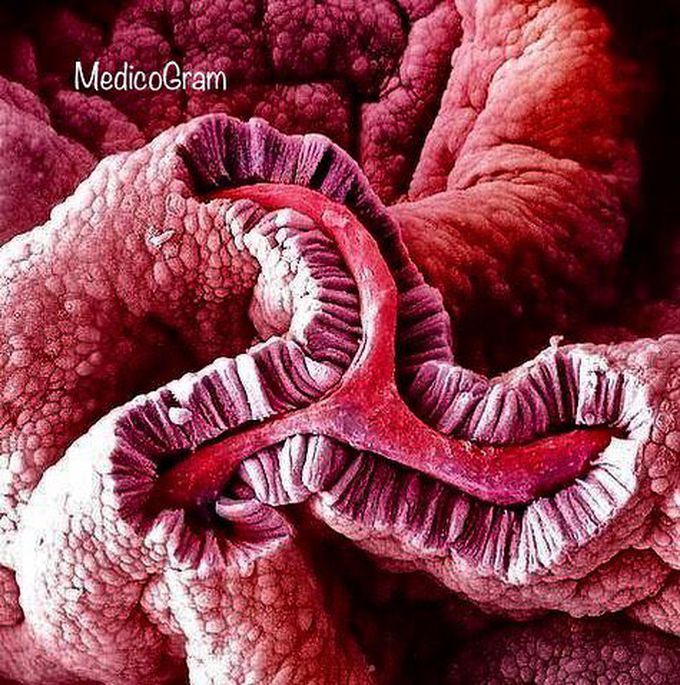 Electron Micrograph of Simple columnar epithelium of Gallbladder