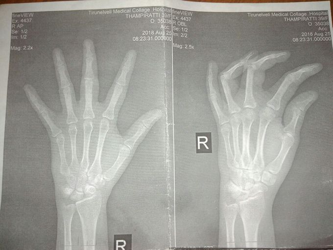 Diagnosis !