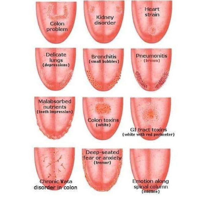 Tongue diagnosis.