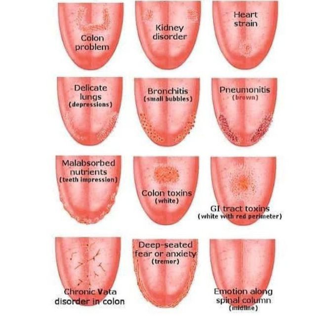 tongue-diagnosis-medizzy