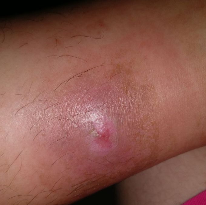 NEED HELP