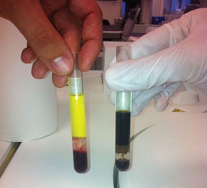 Chocolate-coloured serum