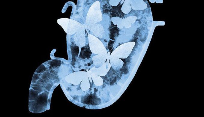 Nervous Patient's KUB Shows Butterflies in Her Stomach | GomerBlog
