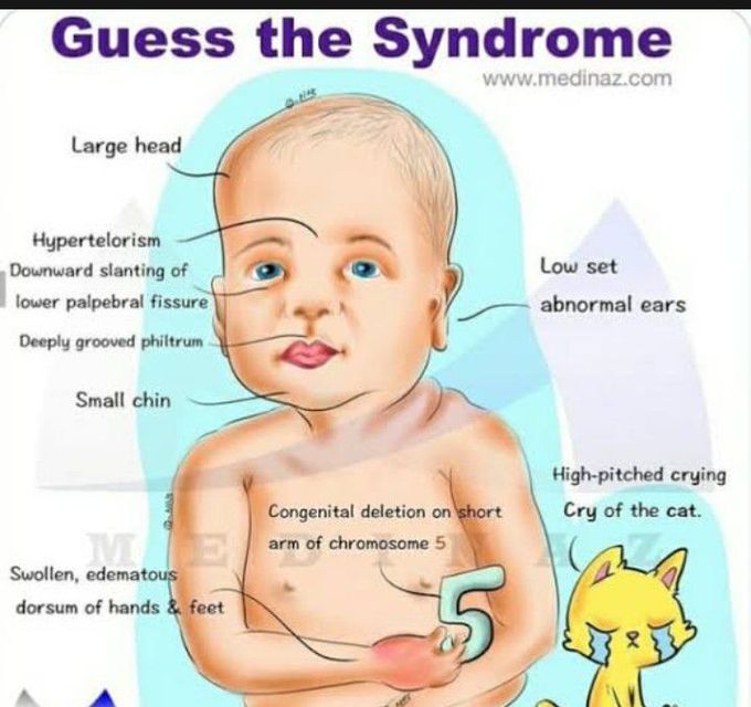 Cri-Du-chat Syndrome