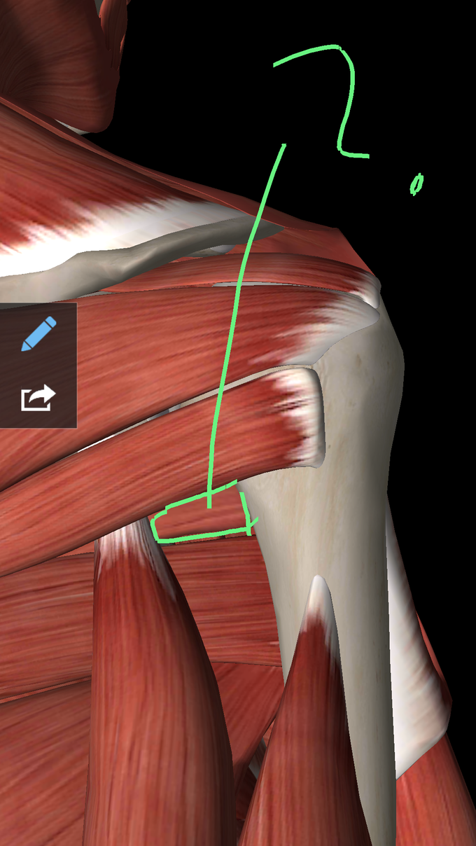 Intermuscular space of upper limb