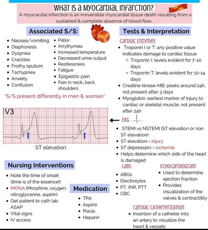 What is Myocardial infarction? - MEDizzy