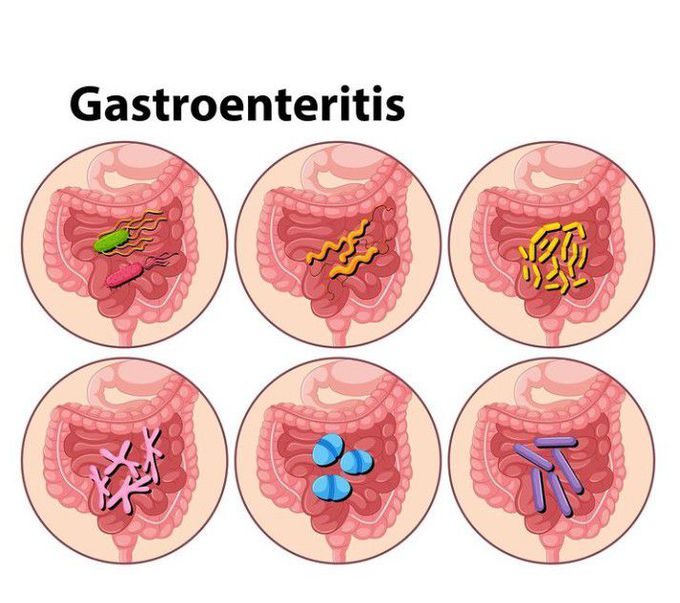 Gastroenteritis⁠