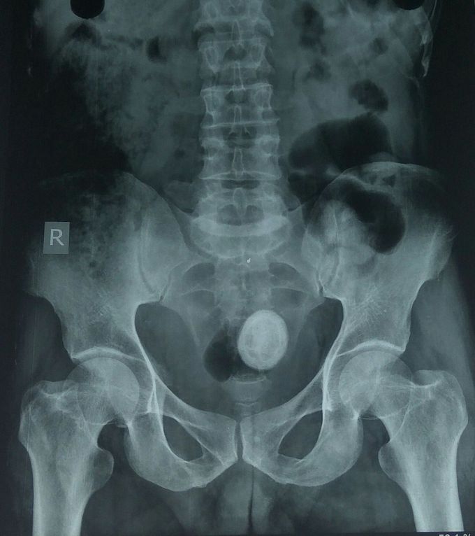 Radiology