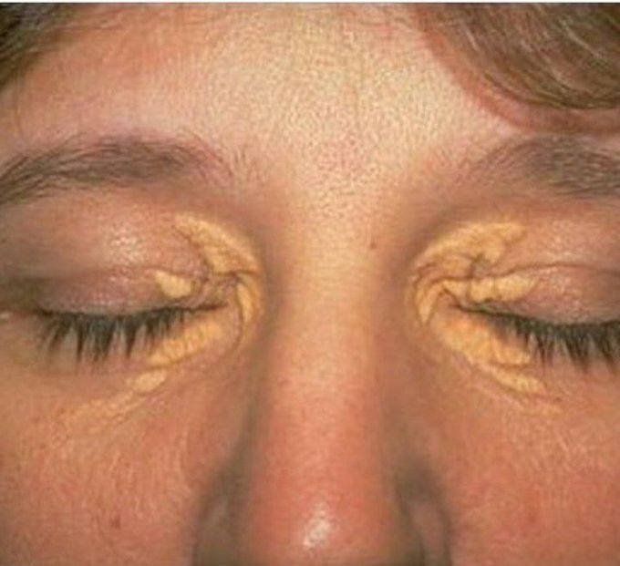Diagnosis???
