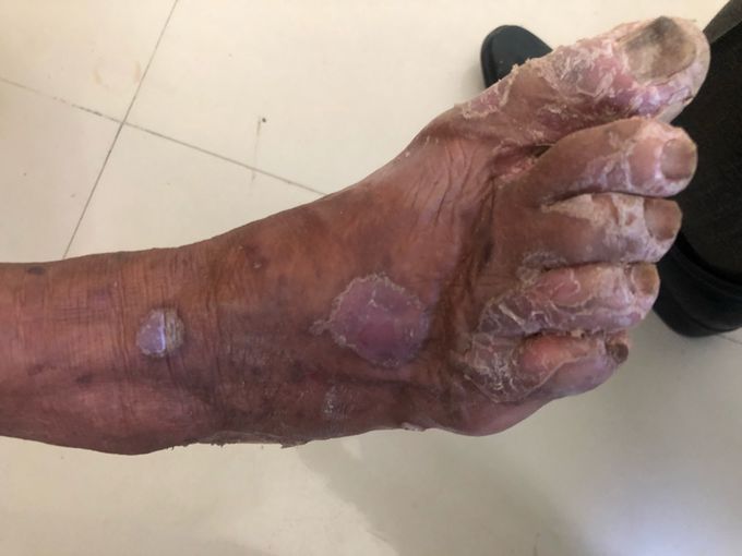 Dermatology