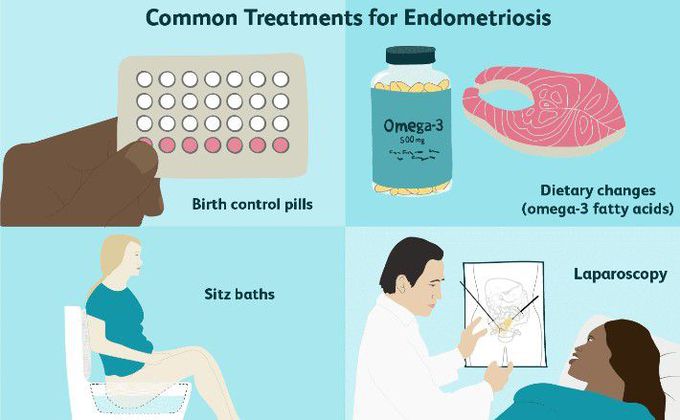 Treatment for Endometriosis
