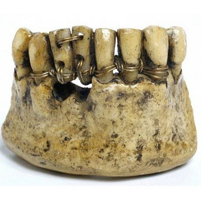 The earliest evidence of ancient dentistry