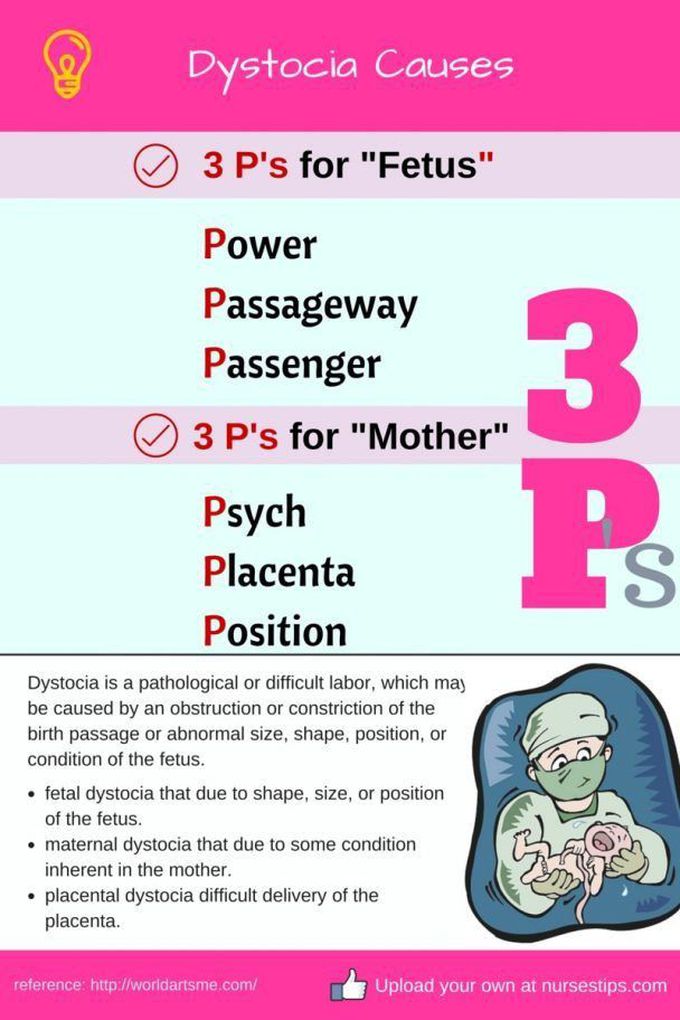 Dystocia cause