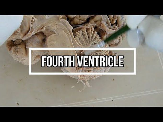 Anatomy of the Fourth Ventricle