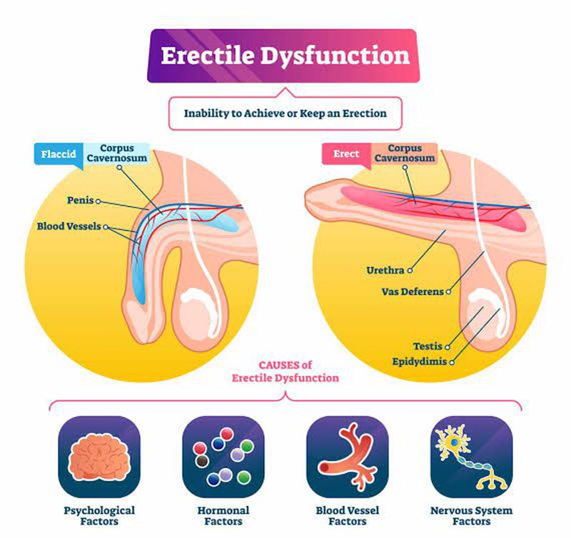 What is Erectile dysfunction MEDizzy