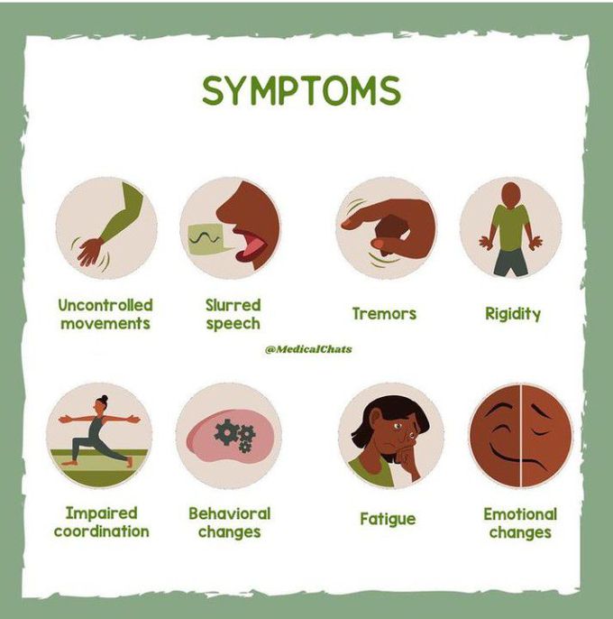 Symptoms of the Huntington's disease