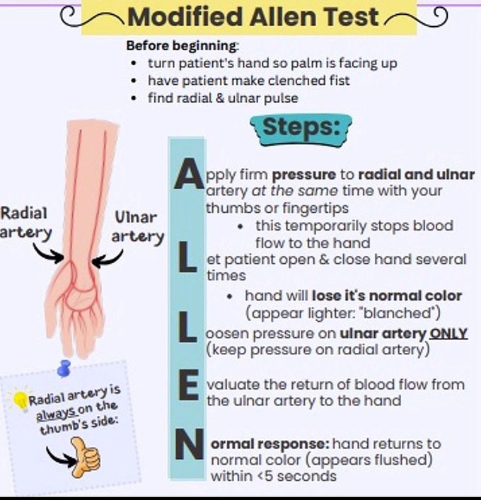 Modified Allen Test