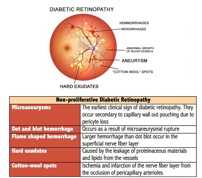 Diabetic Retinopathy