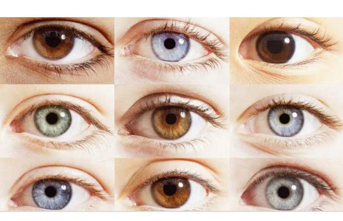 Types of Iris Color