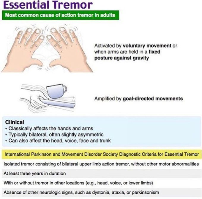 Essential Tremor - MEDizzy