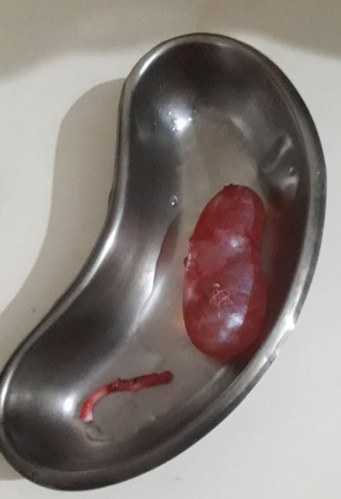 What is this ??