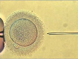 intracytoplasmic sperm injection of human egg - MEDizzy