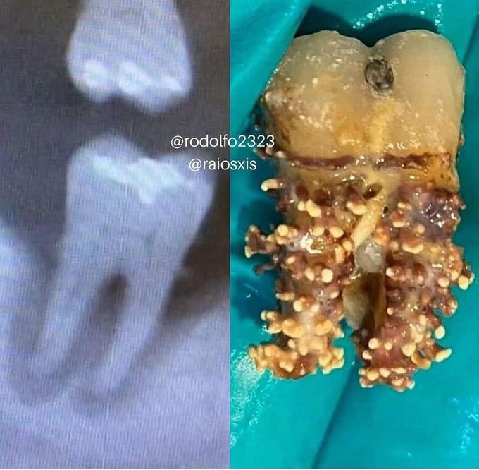 Identify the Pathology