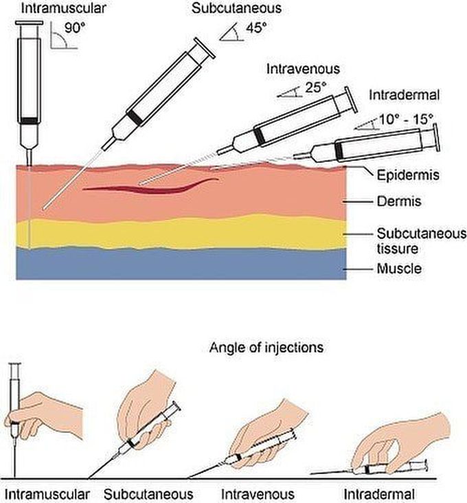 Angle of injections