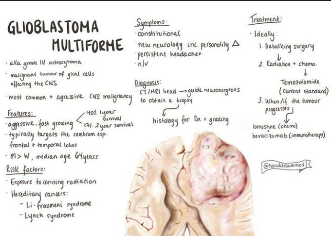 Glioblastoma multiforme