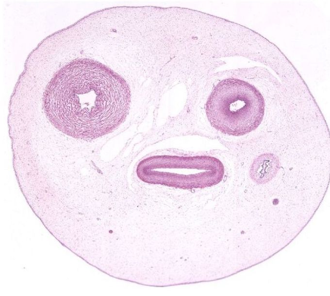 IDENTIFY THE HISTOPATH SLIDE..??