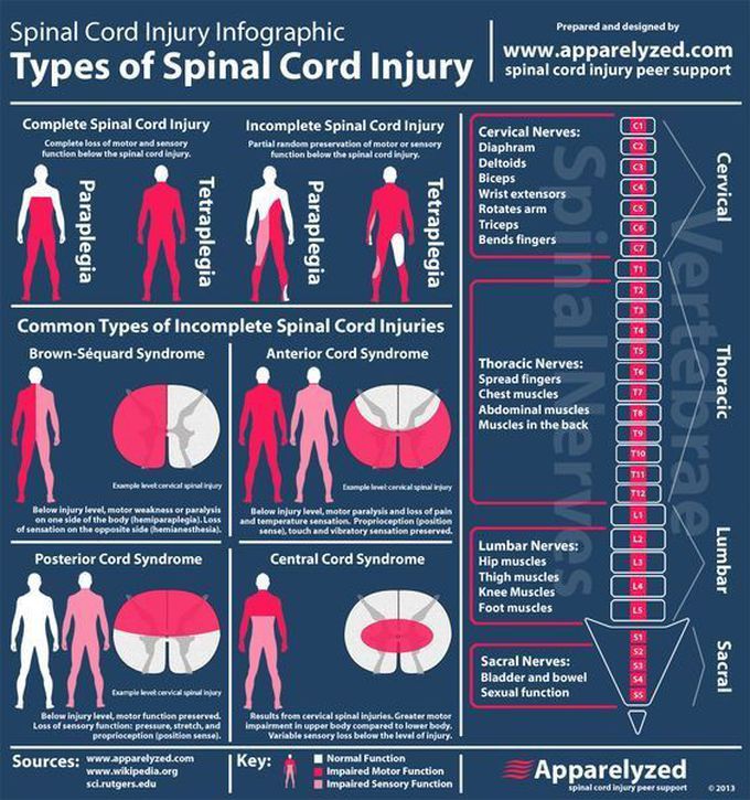 Spinal cord injury types