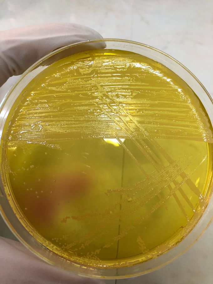 Staphylococcus aureus on Mannitol salt agar