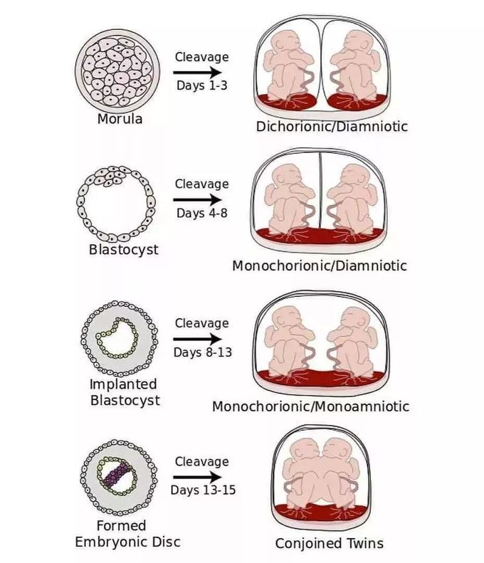 Monozygotic Twins