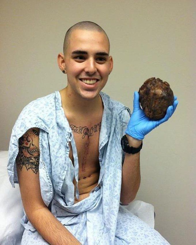 he-s-a-heart-transplant-survivor-and-he-s-holding-up-his-medizzy