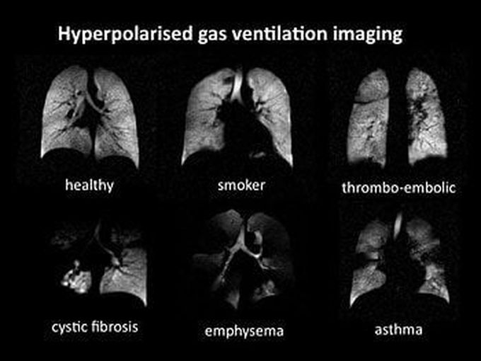 Lung imaging