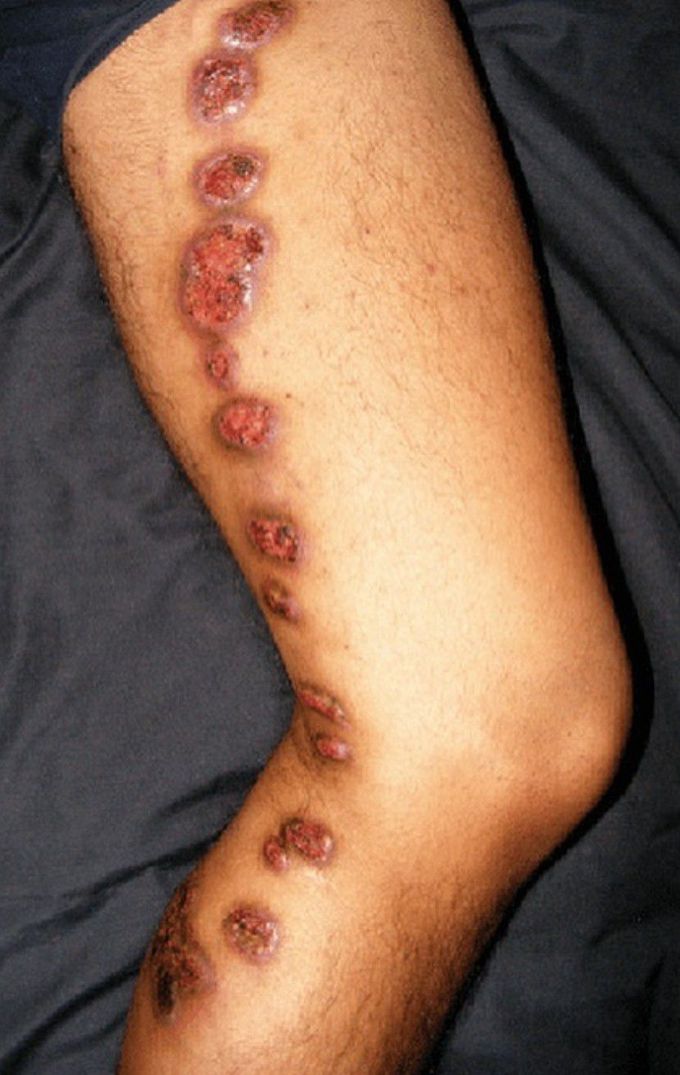 What's the Diagnosis?
