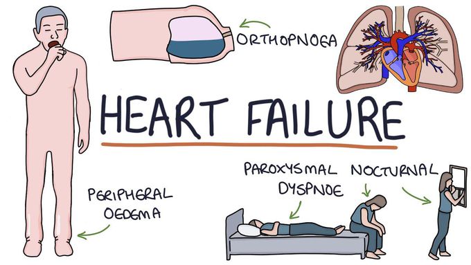 Learning about heart failure